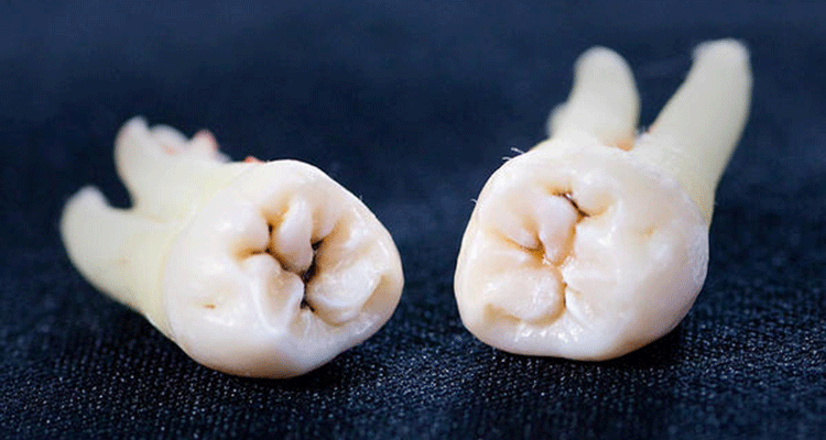 「歯科」と「口腔外科」の違い